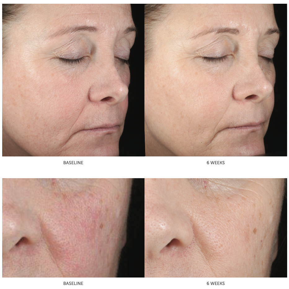 Hyaluronic Acid Serum | Deep Hydration for All Skin Types